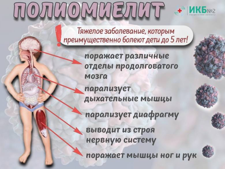 Чем опасен полиомиелит?.